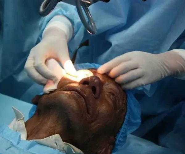 华熙健康行 | 赞助光明行慈善活动